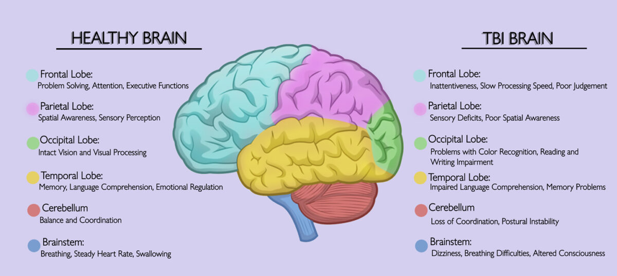 Understanding How Traumatic Brain Injury Affects Thinking, Memory, and Behavior